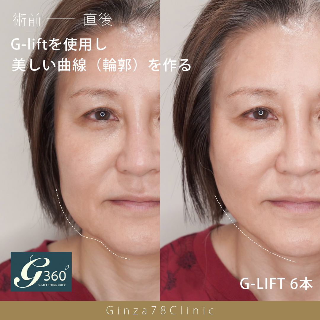 銀座78クリニック公式サイト掲載の症例写真 1
