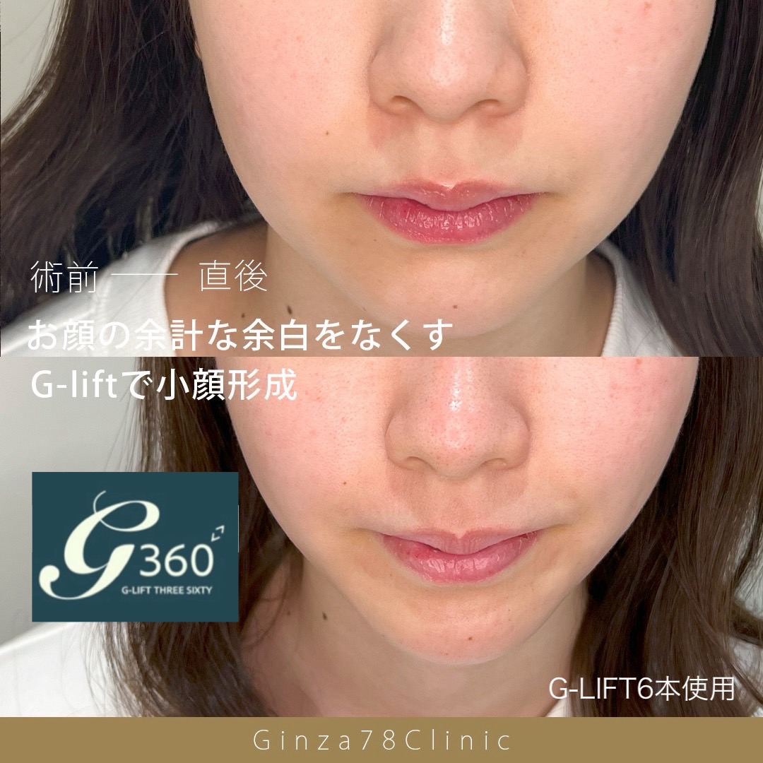 銀座78クリニック公式サイト掲載の症例写真 2