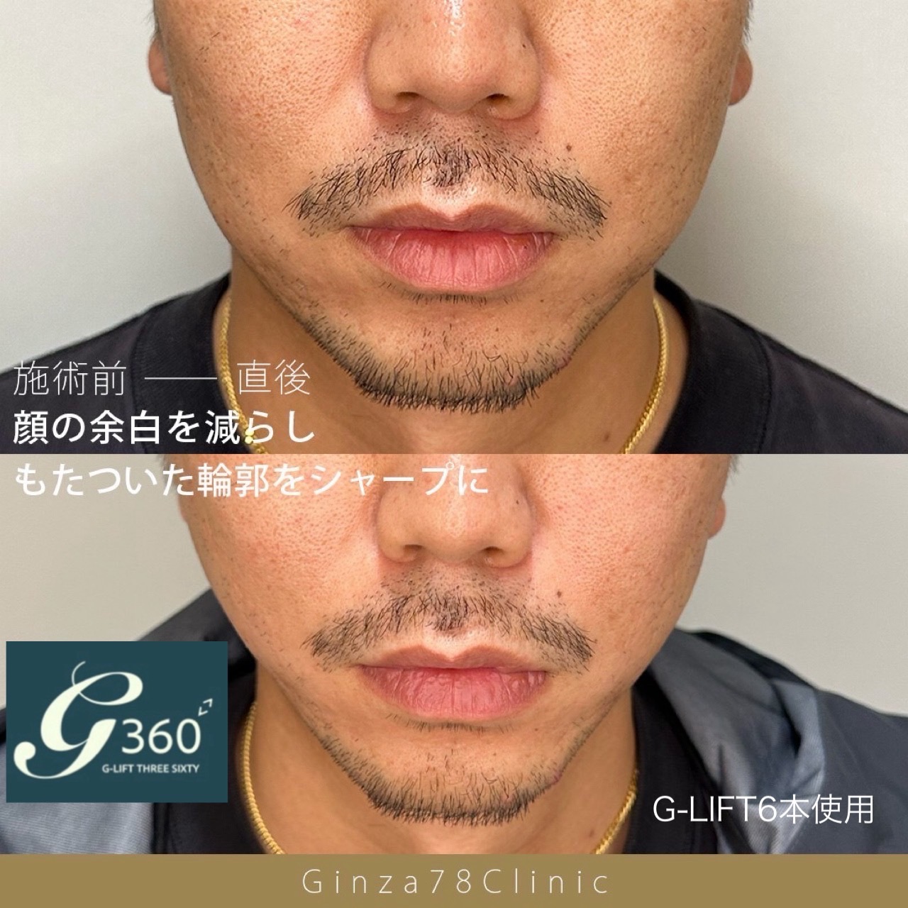 銀座78クリニック公式サイト掲載の症例写真 3